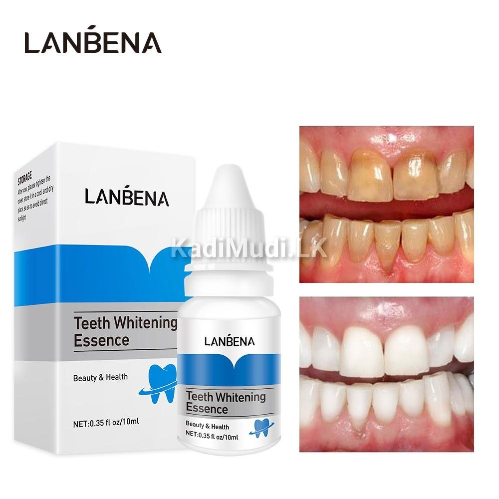 Teeth Whitening Kit – LANBENA